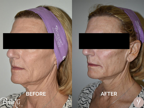 Face Procedures Case 7