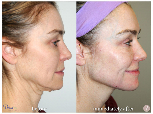 Face Procedures Case 5