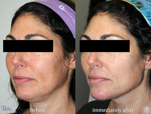 Face Procedures Case 2