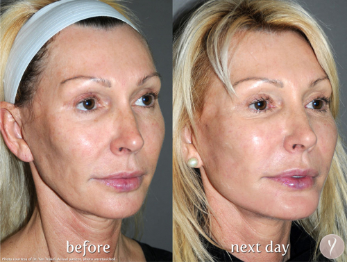 Face Procedures Case 4